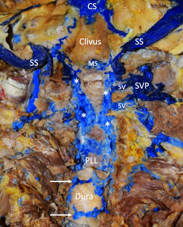 文献查阅|文献综述——椎静脉丛