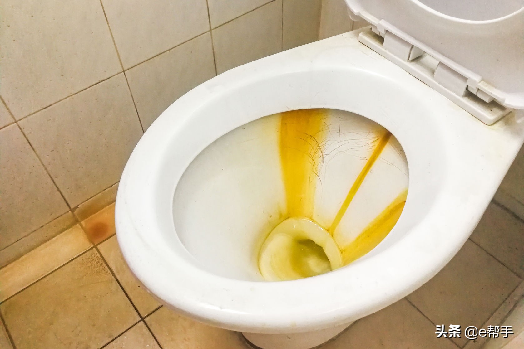 清除马桶污渍这5个办法便宜有效,清除马桶污渍的好方法