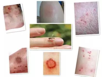 行军拉练，是时候保护好自己的“面子”了