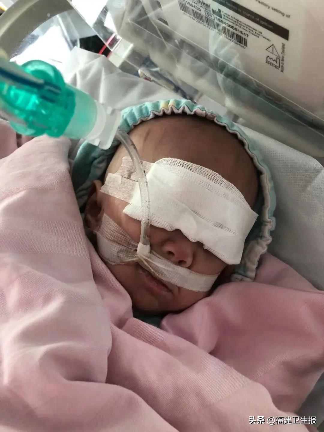 早产儿在nicu里面是怎样的,他一出生就被死神夺走一切