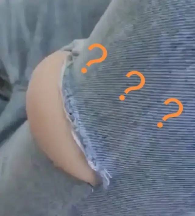 溜冰摔了膝盖关节处肿了,溜冰摔倒了膝盖不能弯曲