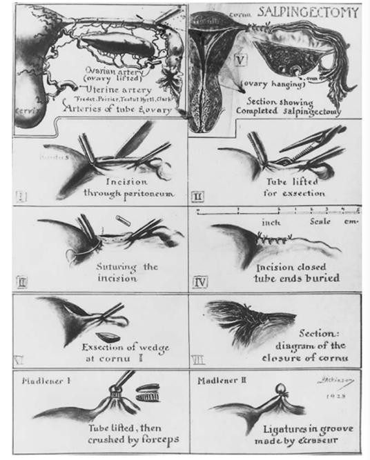 美国夺取印第安人土地的方式,美国对印第安人的灭族罪行