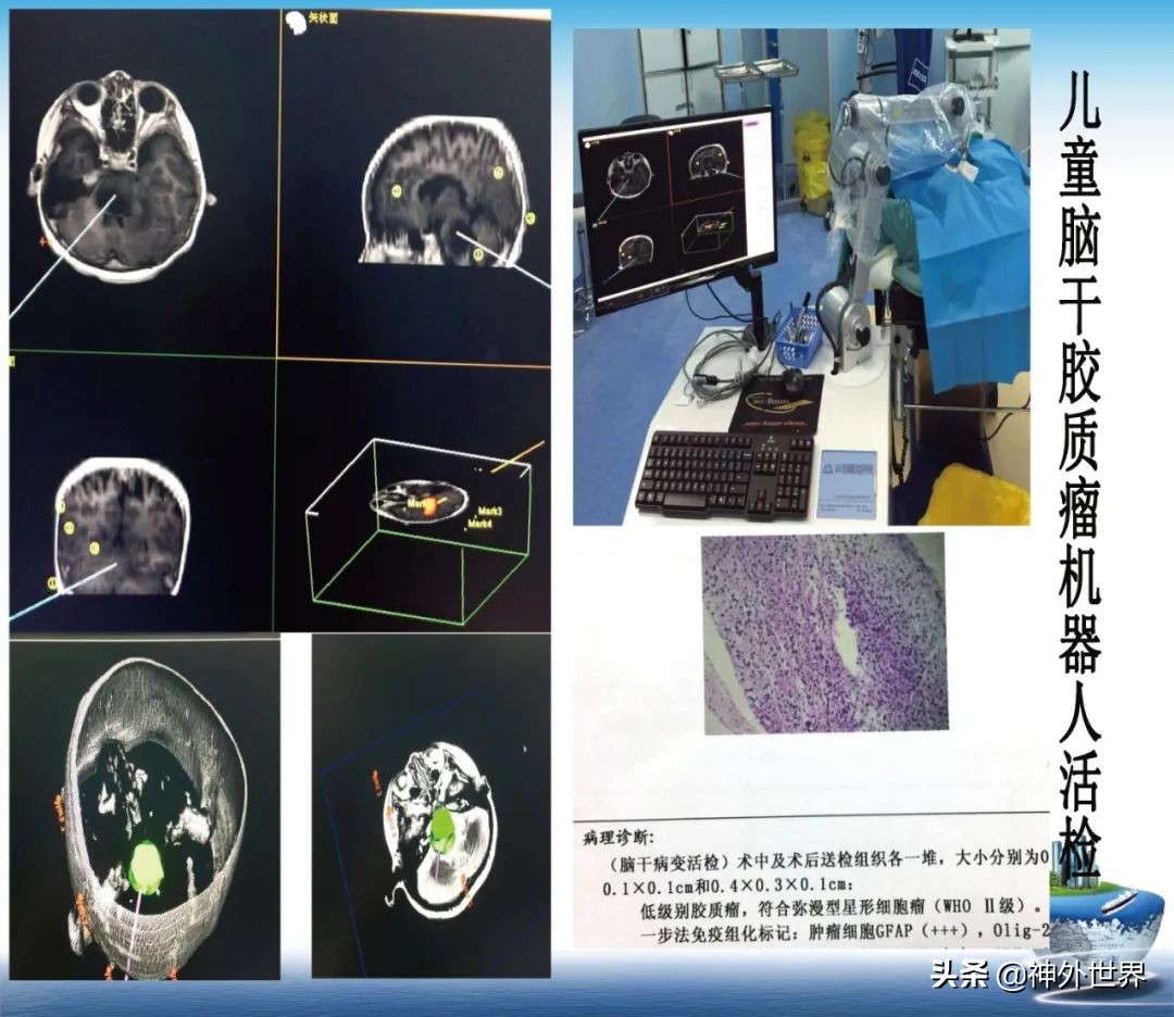 宣武医院神经外科王亚明祖籍,北京宣武医院神经科专家王亚明