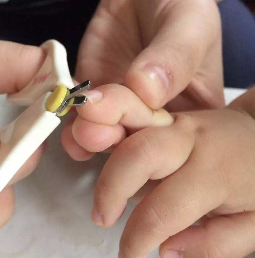 从宝宝手指甲看健康,辨别宝宝健康多观察宝宝指甲