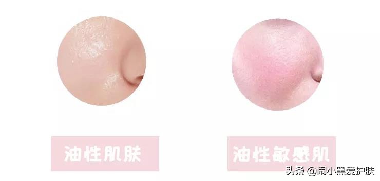 常见问题qa是什么意思,qa常见问题