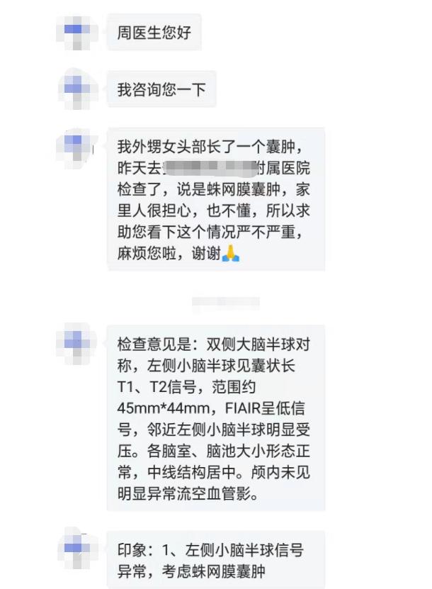 病例咨询:22个月大的小女孩,患了蛛网膜囊肿,该不该手术?