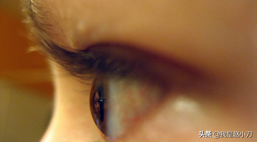 年轻人做白内障手术好吗,年轻人做白内障手术的前途