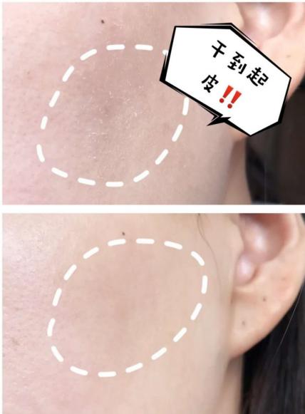 郁美净无硅油儿童面霜,郁美净为什么突然买不到了