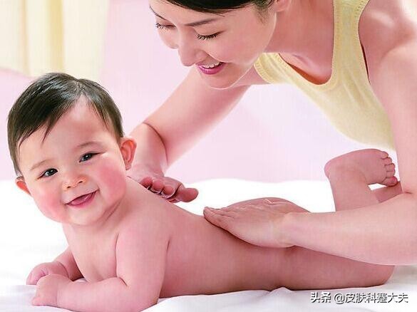 湿疹的最佳软膏无激素,湿疹抹激素软膏会有什么副作用