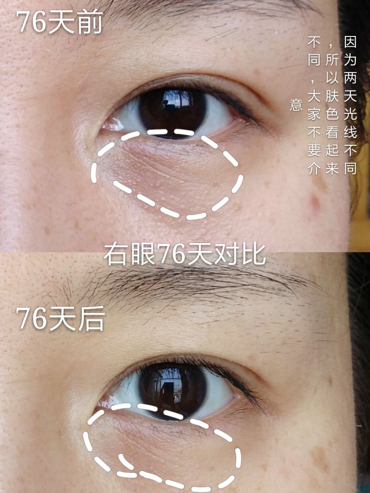 梵西六胜肽抗皱精华,薇娅梵西六胜肽精华液