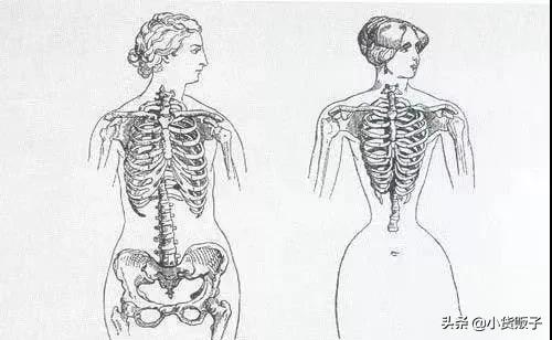 内脏下垂、子宫脱落、漏尿…今天和你一起说一说束腰的危害