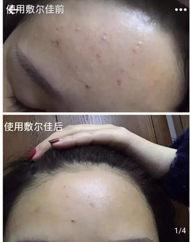 敷尔佳面膜好不好用？黑膜、白膜、绿膜、灯泡膜都有什么区别？