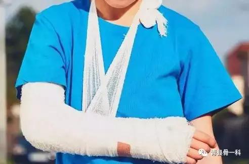 促进骨折愈合的方法有哪些,促进骨折愈合要吃什么恢复得较快