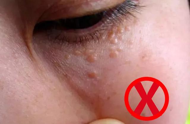 眼霜到底有没有用啊,眼霜里面有什么成分不能用