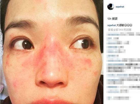 「丽皙白」脸部时常感到有刺痛感，那是你还没做好这几步护肤步骤！