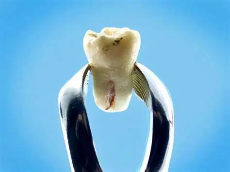 其实拔牙没有想象中可怕,你以为拔牙很简单吗