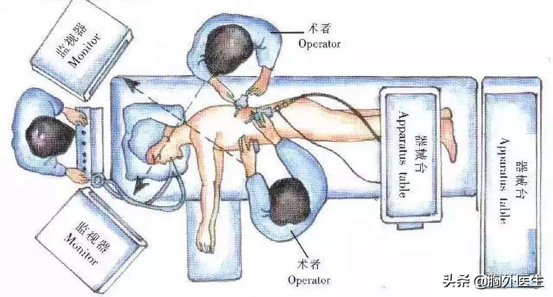 肺结节属于什么肺病,肺结节是什么病需要做化疗吗