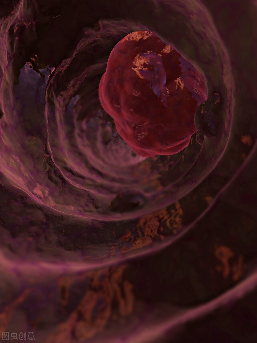 肠息肉都要切除吗？术后护理事项有？