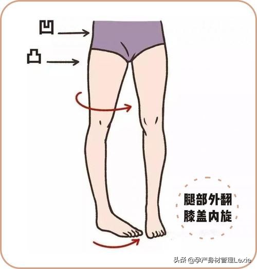 产后臀部下垂怎么变宽,产后假胯宽屁股变大怎么恢复