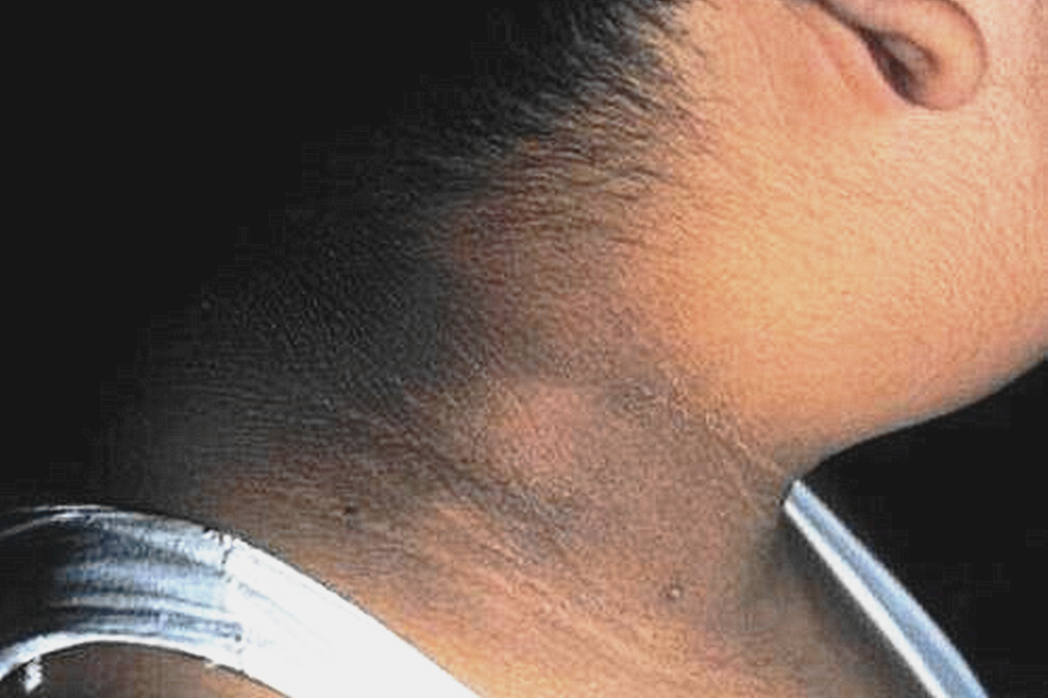 小孩子脖子黑像洗不干净用什么药,儿童脖子黑洗不掉用看医生吗