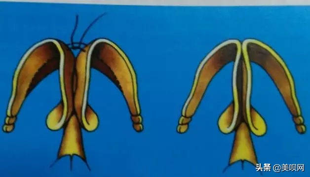 明星都在用的缩小鼻翼神器,明星鼻子做鼻翼缩小外切