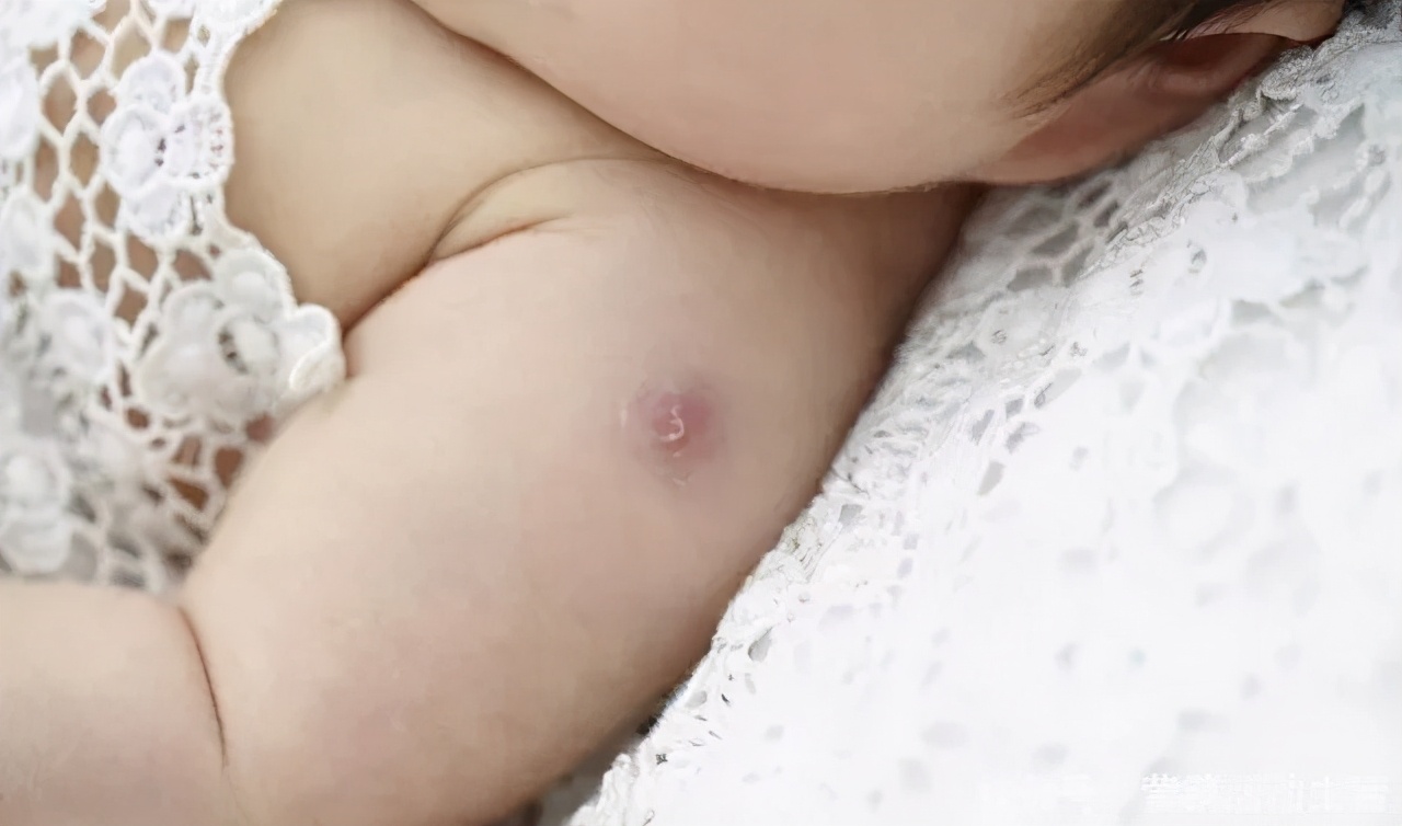 孕妇乙肝检查全都是阴性,孕妇乙肝携带者会传染给孩子吗