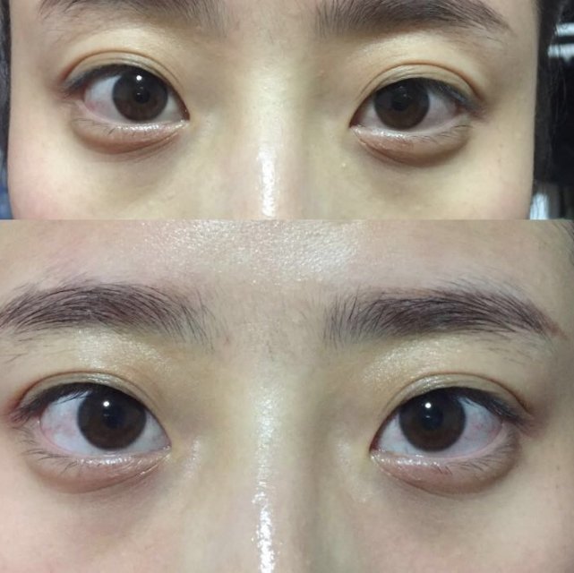 日本晓姿御颜晶采多效修护眼膜,日本晓姿眼膜哪款抗皱