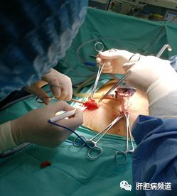 晚期胃癌转移卵巢怎么办,晚期胃癌转移肝有必要治疗么