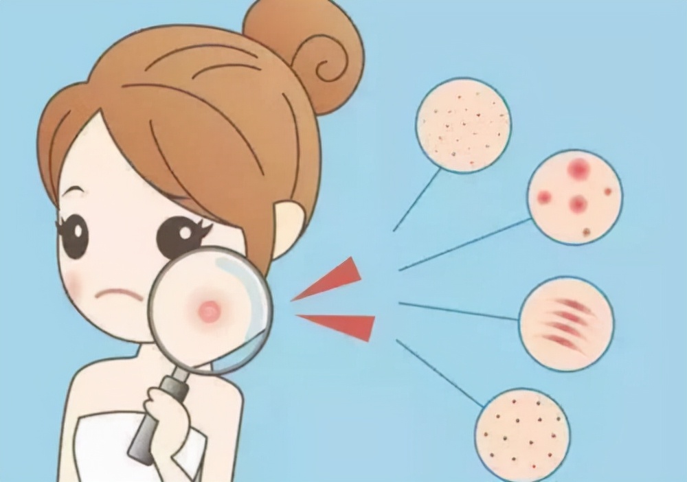 脸部皮肤过敏修护肌肤屏障,脸部过敏皮肤屏障受损了怎么调理