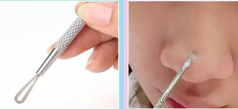 油皮去黑头最有效的方法,油皮黑头有效护肤教程