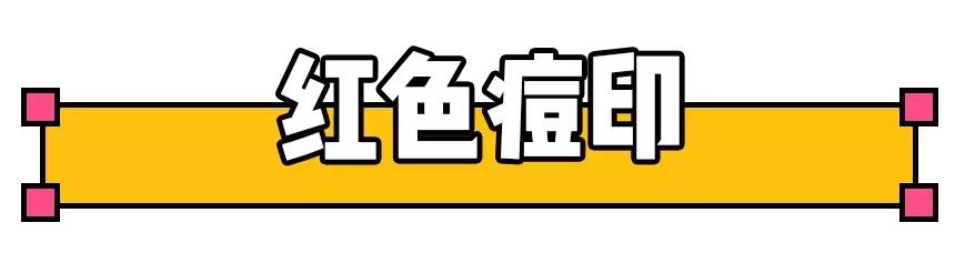 库博士祛痘怎么收费,库博士专业祛痘怎么样