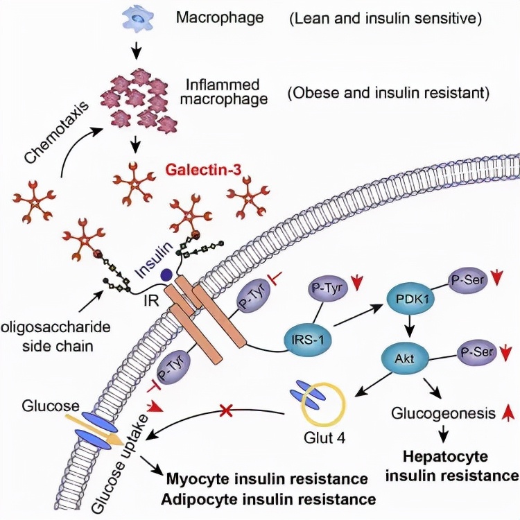 最新上市的降血糖药物有哪些,中国最新研发的口服降糖药