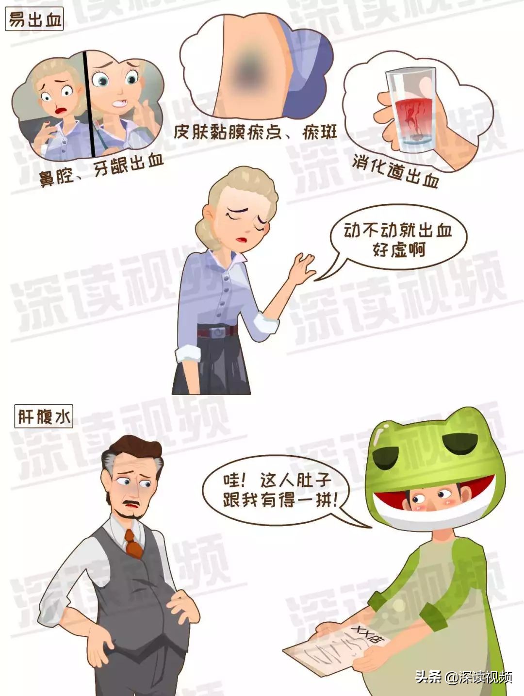 早期肝硬化有什么蛛丝马迹吗,如何判定早期肝硬化和晚期肝硬化