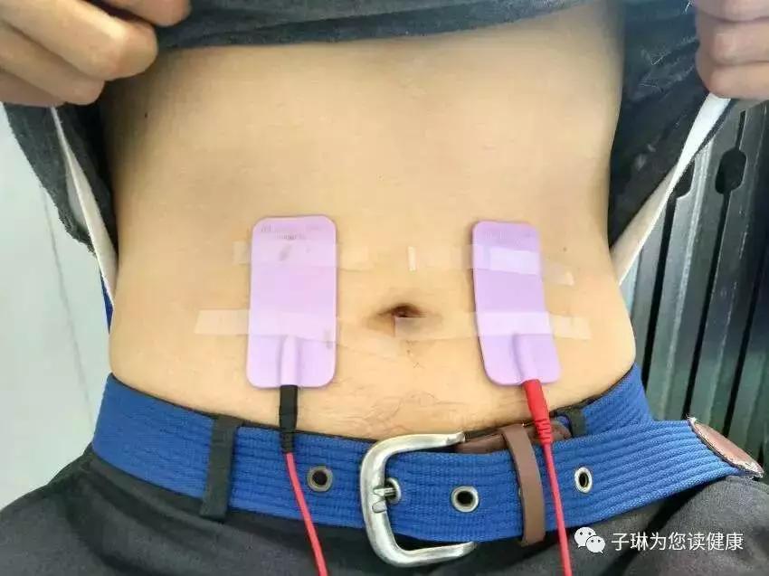 打了无痛分娩一年还疼,打了无痛分娩生孩子会关掉无痛吗