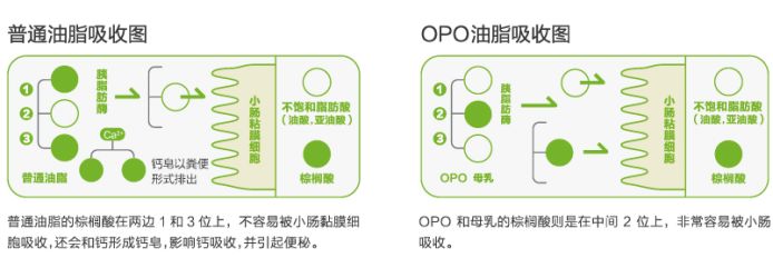 婴儿吃完奶就拉便便带有奶瓣,三个月宝宝拉黄绿色便便带奶瓣