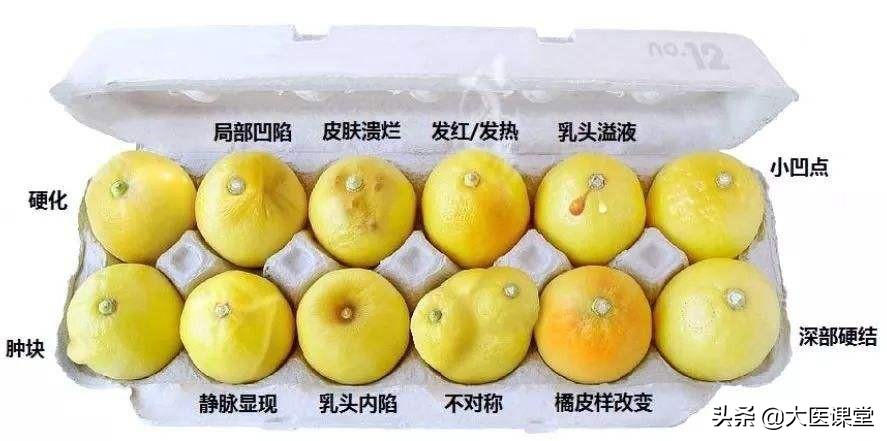 怎样用手触摸判断乳腺结节,乳腺结节怎么摸才准确