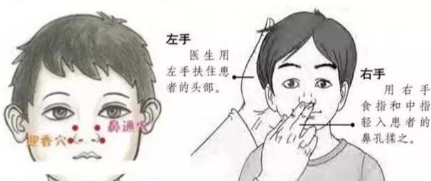 小孩鼻塞推拿穴位,孩子鼻塞推拿背部