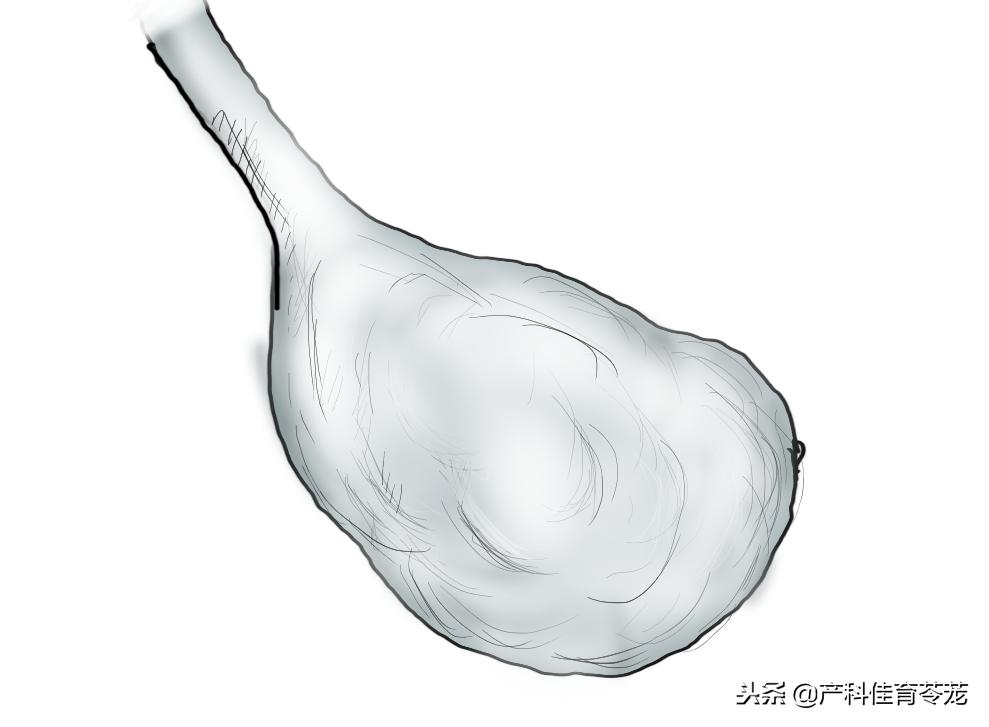 做b超能看见卵巢吗,妇科b超结果显示卵巢什么意思