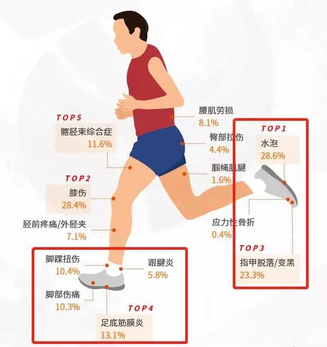 给孩子买鞋三大忌,给孩子买鞋买正好的还是买大点的