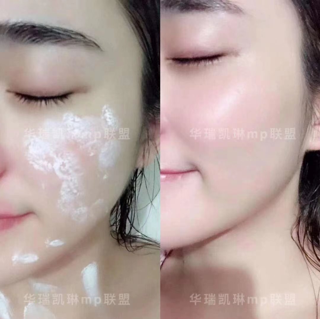 祛斑美肤最有效的滋养霜