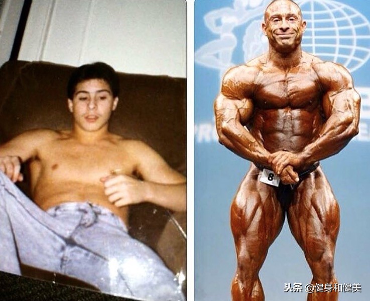 使用类固醇增肌,健美达人类固醇引发肾衰竭