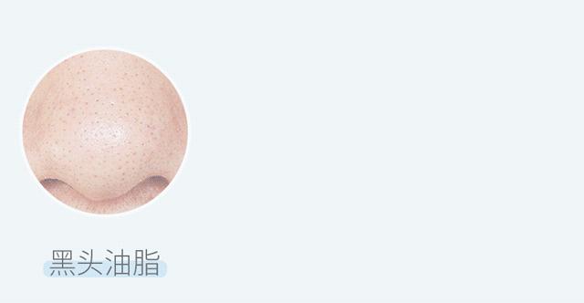 去角质慕斯可以去除死皮么,去角质慕斯去不去死皮