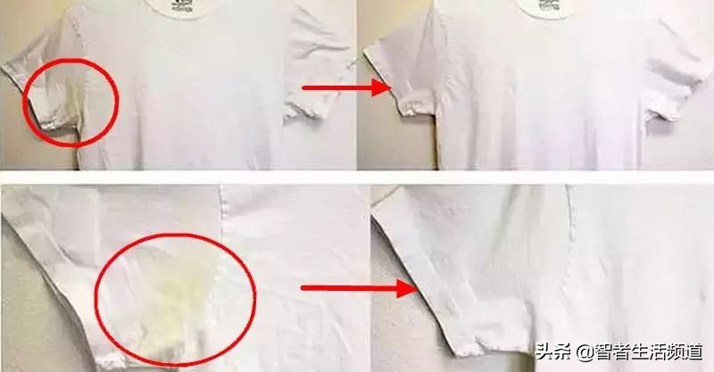 如何清洗白衣上霉斑,白衣服油渍怎么快速洗