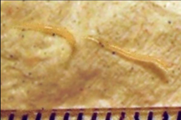 现在小学生要打虫吗,孩子打虫的季节