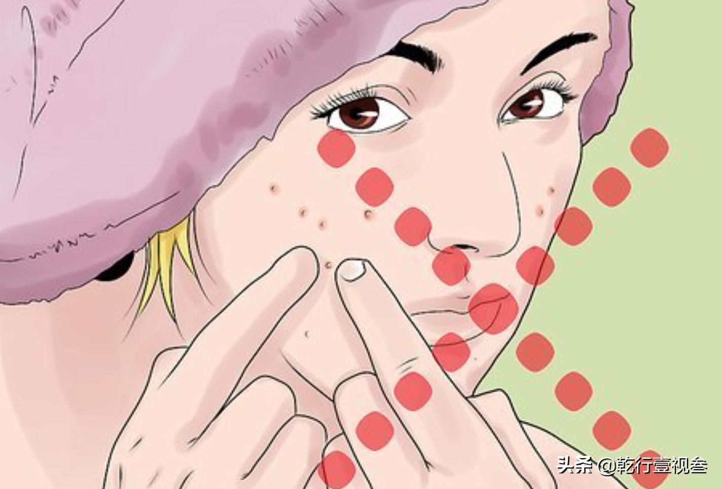 如何预防和祛除青春痘（上）