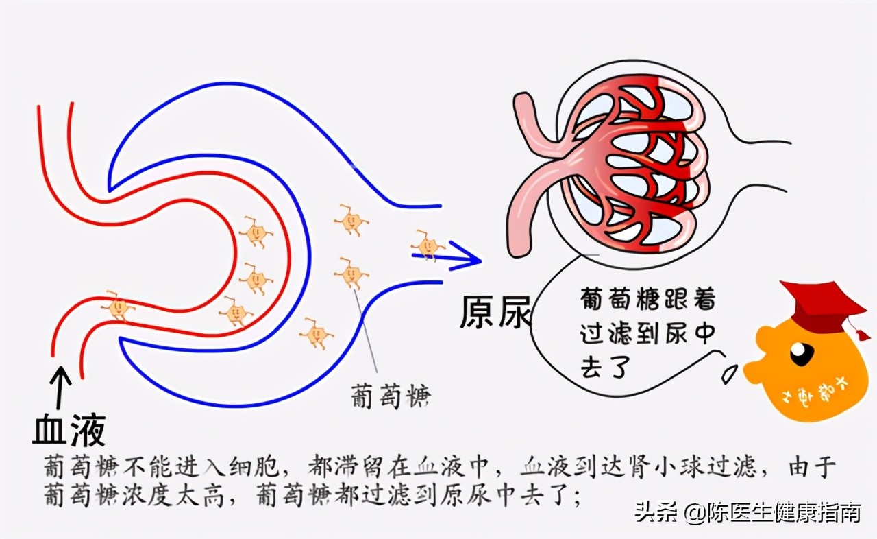 糖尿病胰岛功能会越来越差么,二型糖尿病胰岛功能会越来越差吗