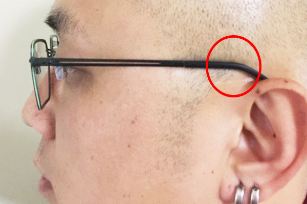 近视的医疗干预措施有哪四种,近视500度可以拯救吗