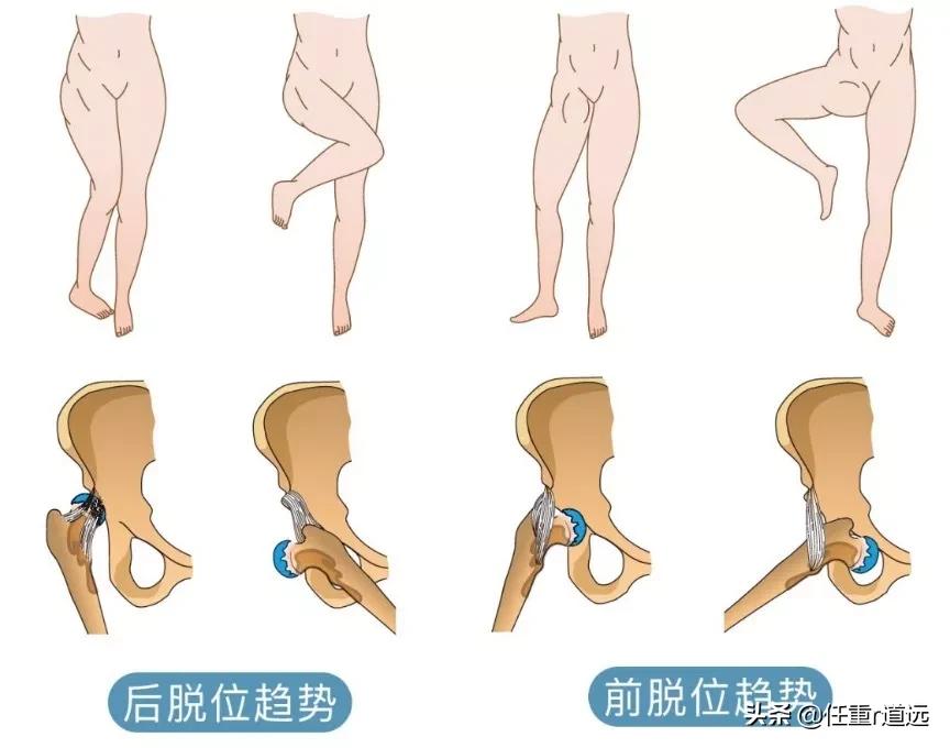屁股大假胯宽腿粗最简单方法,改善假胯宽屁股大的动作