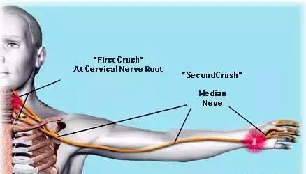 手臂发麻又酸痛是怎么回事,手臂总感觉发麻是什么原因