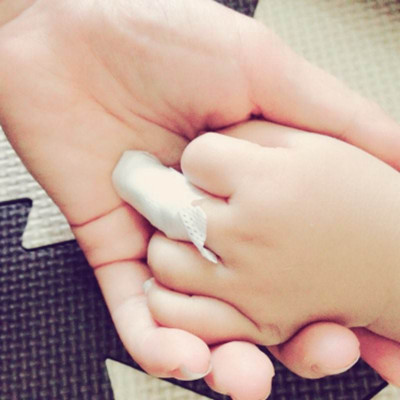 宝宝手指夹烂了怎么处理,宝宝手夹伤用什么药